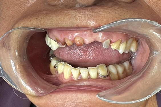 Después de estética dental